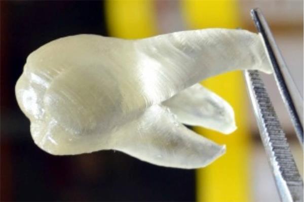Imprimée en 3D, cette dent tue les bactéries responsables des carries